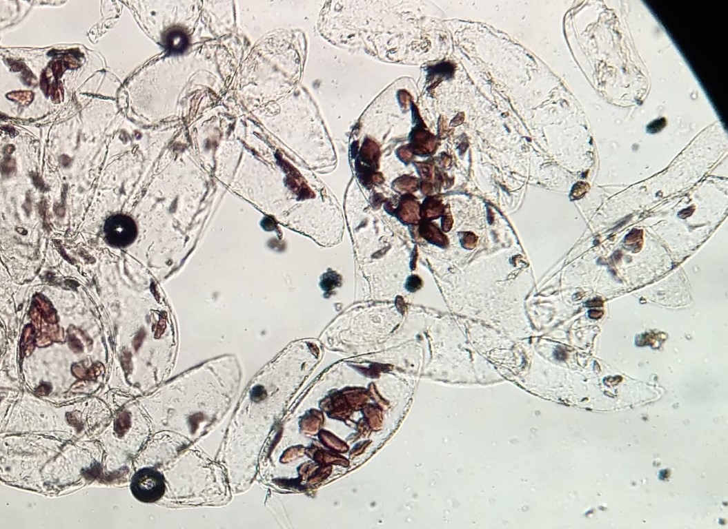 Amyloplasten